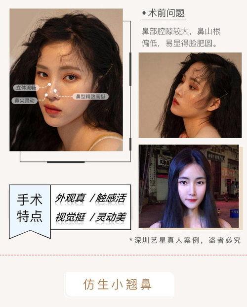 网红俏鼻,揭秘网络红人的魅力秘诀